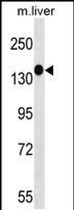 PEAK1 Antibody in Western Blot (WB)