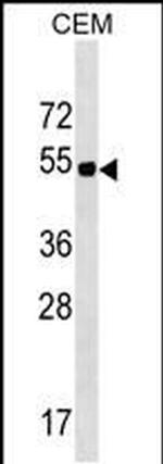 ELL3 Antibody in Western Blot (WB)