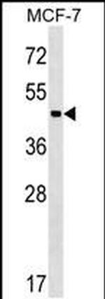 ZBTB12 Antibody in Western Blot (WB)