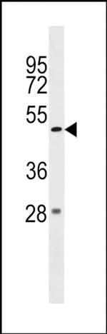 ZBTB47 Antibody in Western Blot (WB)