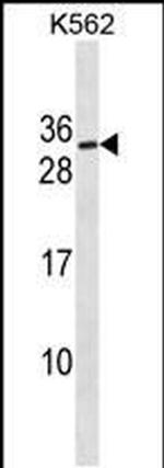 SSX3 Antibody in Western Blot (WB)