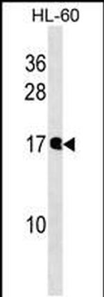 NUDT10 Antibody in Western Blot (WB)