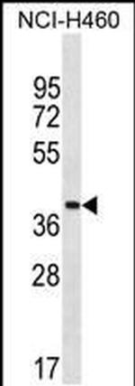 ZNF488 Antibody in Western Blot (WB)