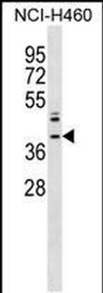 ZNF75A Antibody in Western Blot (WB)