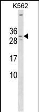 KCNE4 Antibody in Western Blot (WB)