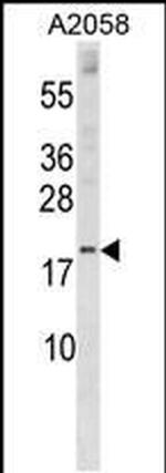 SNX3 Antibody in Western Blot (WB)