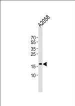 SNX3 Antibody in Western Blot (WB)