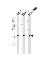 SNX3 Antibody in Western Blot (WB)