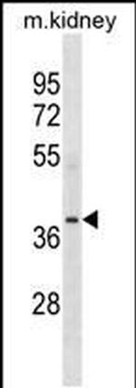 POC1A Antibody in Western Blot (WB)