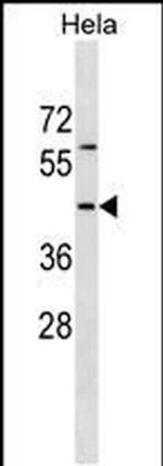 RBM41 Antibody in Western Blot (WB)