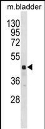 RBM41 Antibody in Western Blot (WB)