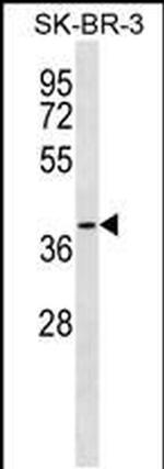 SFXN3 Antibody in Western Blot (WB)