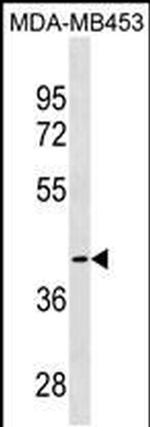 CCBL1 Antibody in Western Blot (WB)