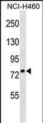 ZNF607 Antibody in Western Blot (WB)