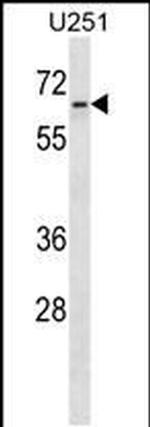 ZNF768 Antibody in Western Blot (WB)