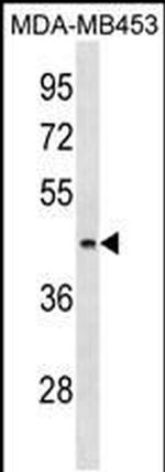 ALG8 Antibody in Western Blot (WB)