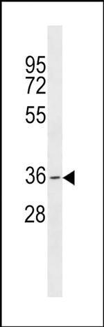 GDF5OS Antibody in Western Blot (WB)