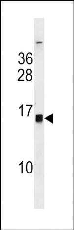 HIST1H2BH Antibody in Western Blot (WB)