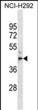 MPPE1 Antibody in Western Blot (WB)