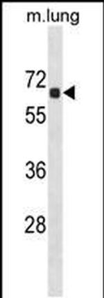 ACOT9 Antibody in Western Blot (WB)