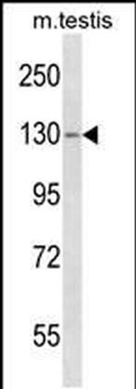 TBC1D2 Antibody in Western Blot (WB)