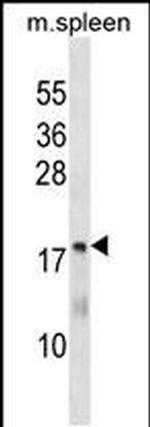 MTHFS Antibody in Western Blot (WB)