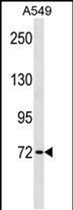 KBTBD7 Antibody in Western Blot (WB)