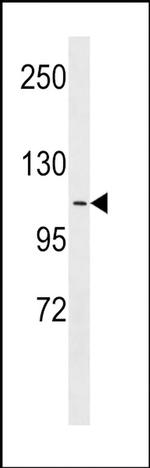 APOB48R Antibody in Western Blot (WB)