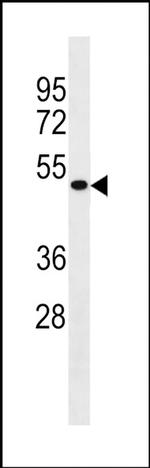 IDAS Antibody in Western Blot (WB)