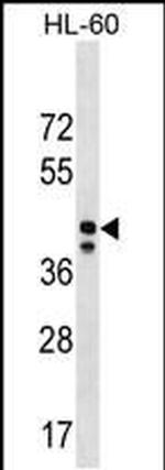 MRPS31 Antibody in Western Blot (WB)