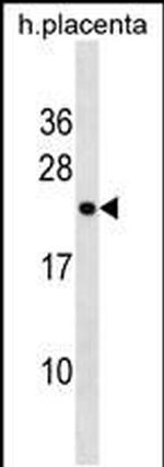 RNF122 Antibody in Western Blot (WB)