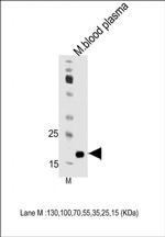 Apolipoprotein M Antibody in Western Blot (WB)