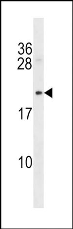 B-myc Antibody in Western Blot (WB)