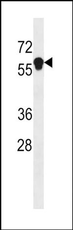 ANKDD1B Antibody in Western Blot (WB)