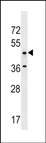 ANKRD61 Antibody in Western Blot (WB)