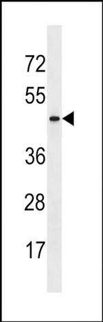 ARMCX4 Antibody in Western Blot (WB)