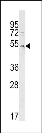 DCAF12L2 Antibody in Western Blot (WB)