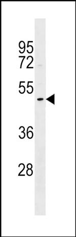 DNASE1L1 Antibody in Western Blot (WB)