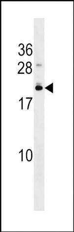 EFCAB10 Antibody in Western Blot (WB)