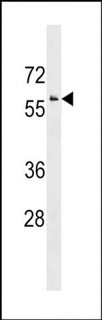 IRG1 Antibody in Western Blot (WB)