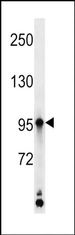 Kazrin Antibody in Western Blot (WB)