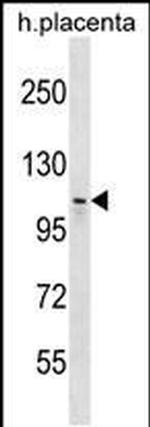MMS19 Antibody in Western Blot (WB)