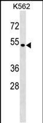 SMAP1 Antibody in Western Blot (WB)