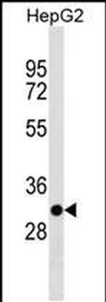 TARM1 Antibody in Western Blot (WB)