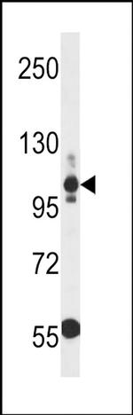 Thrombospondin 3 Antibody in Western Blot (WB)