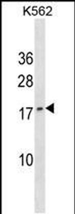 GCHFR Antibody in Western Blot (WB)