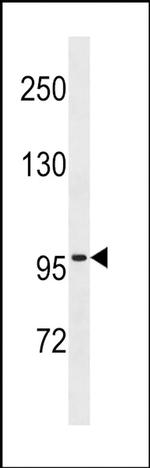 ZNF229 Antibody in Western Blot (WB)
