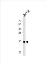 UBE2D4 Antibody in Western Blot (WB)