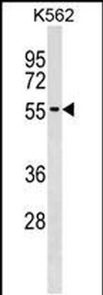 UTP3 Antibody in Western Blot (WB)