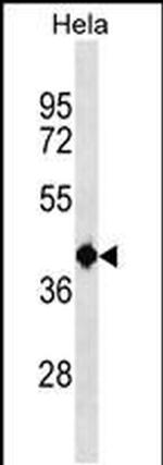 TSEN2 Antibody in Western Blot (WB)